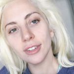 Lady Gaga plastic surgery (2)
