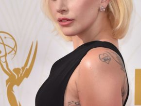 Lady Gaga plastic surgery (23)
