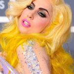Lady Gaga plastic surgery (25)