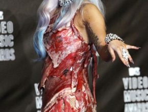 Lady Gaga plastic surgery (28)
