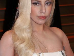 Lady Gaga plastic surgery (38)