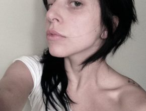 Lady Gaga plastic surgery (49)
