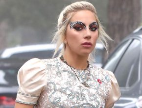 Lady Gaga plastic surgery (5)
