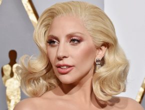Lady Gaga plastic surgery (7)