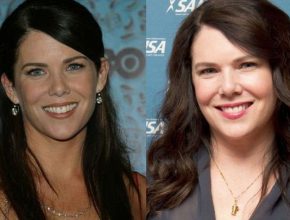 Lauren Graham before and after plastic surgery