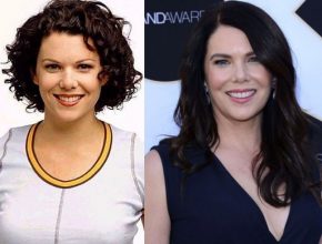 Lauren Graham before and after plastic surgery (3)