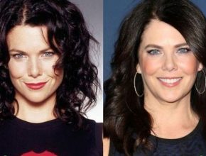 Lauren Graham before and after plastic surgery (39)