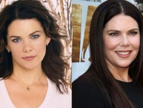 Lauren Graham before and after plastic surgery (40)