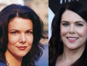 Lauren Graham before and after plastic surgery (5)