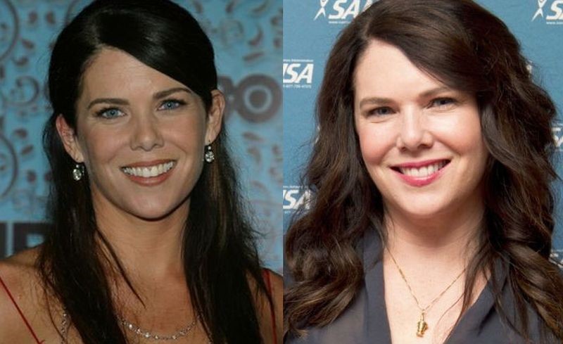 Lauren Graham before and after plastic surgery.
