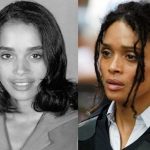 Lisa Bonet before and after plastic surgery