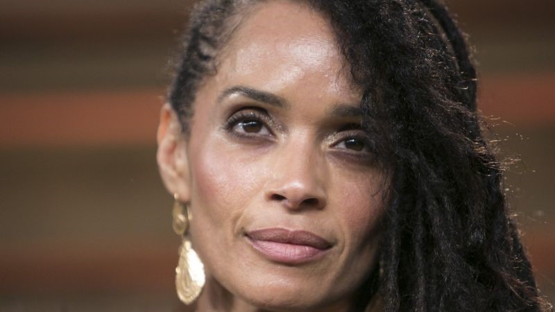 Lisa Bonet plastic surgery