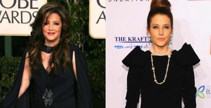 Lisa Marie Presley before and after plastic surgery