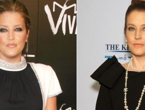 Lisa Marie Presley before and after plastic surgery (36)