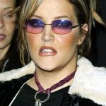 Lisa Marie Presley plastic surgery (1)