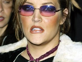 Lisa Marie Presley plastic surgery (1)