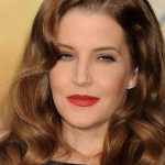 Lisa Marie Presley plastic surgery (16)