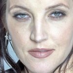 Lisa Marie Presley plastic surgery (18)