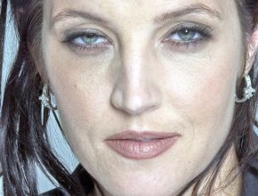 Lisa Marie Presley plastic surgery (18)