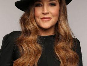 Lisa Marie Presley plastic surgery (21)