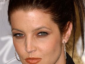 Lisa Marie Presley plastic surgery