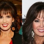 Marie Osmond before and after plastic surgery (15)