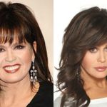 Marie Osmond before and after plastic surgery