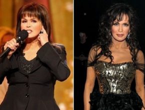 Marie Osmond before and after plastic surgery (34)