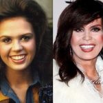 Marie Osmond before and after plastic surgery (8)