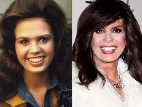 Marie Osmond before and after plastic surgery (8)