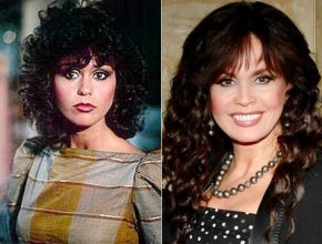 Marie Osmond before and after plastic surgery (9)