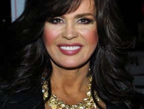 Marie Osmond plastic surgery (12)