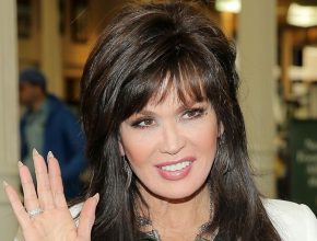 Marie Osmond plastic surgery (21)