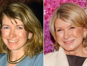 Martha Stewart before and after plastic surgery (15)