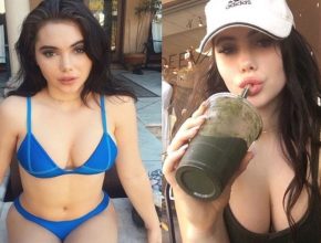 Mckayla Maroney before and after plastic surgery