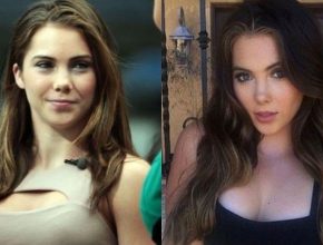 Mckayla Maroney before and after plastic surgery