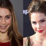 Mckayla Maroney before and after plastic surgery (30)