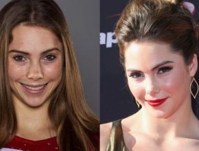 Mckayla Maroney before and after plastic surgery (30)