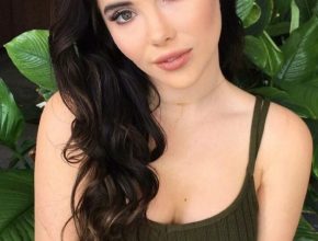 Mckayla Maroney plastic surgery (01)