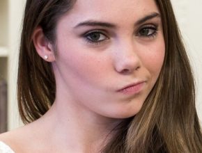 Mckayla Maroney plastic surgery (10)