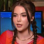 Mckayla Maroney plastic surgery (13)