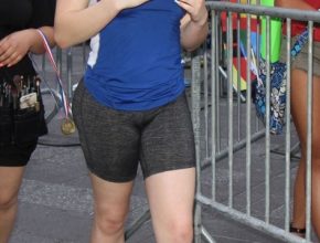 Mckayla Maroney plastic surgery (18)