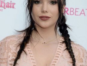 Mckayla Maroney plastic surgery (36)