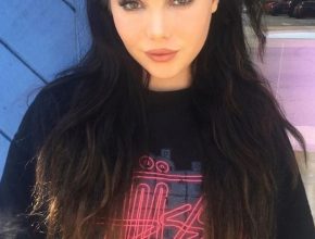 Mckayla Maroney plastic surgery (6)