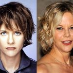 Meg Ryan before and after plastic surgery (22)