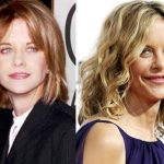 Meg Ryan before and after plastic surgery (3)