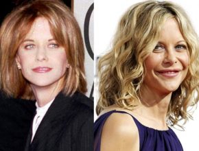 Meg Ryan before and after plastic surgery (3)