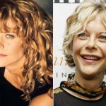 Meg Ryan before and after plastic surgery (9)