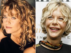 Meg Ryan before and after plastic surgery (9)