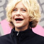 Meg Ryan plastic surgery (7)